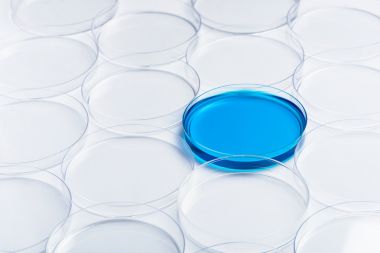 人白介素8(IL-8)酶聯免疫elisa試劑盒生產廠家