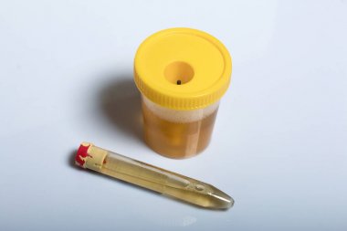 受體TNFRSF結合絲氨酸蘇氨酸激酶2(RIPK2)elisa試劑盒